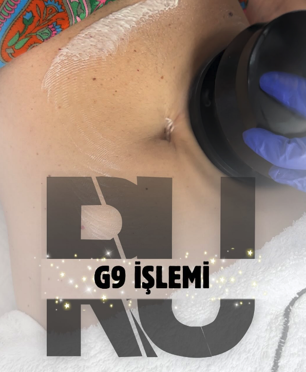 G9 İşlemi